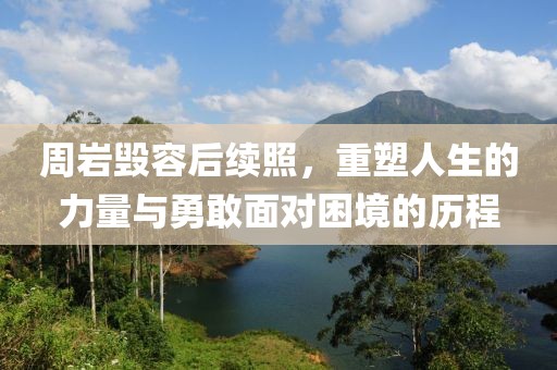 周岩毁容后续照，重塑人生的力量与勇敢面对困境的历程